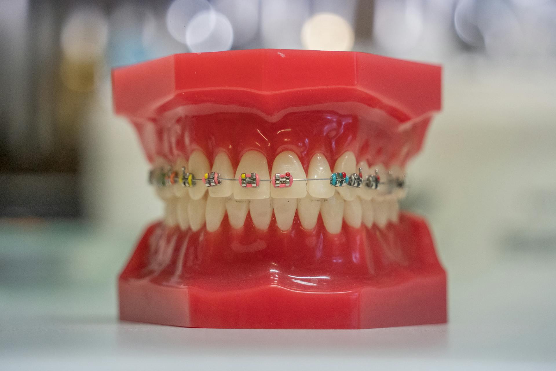 A demonstration of orthodontic treatment using a set of dentures at Victor Crescent Dental Clinic in Narre Warren, showcasing teeth alignment solutions for all ages.