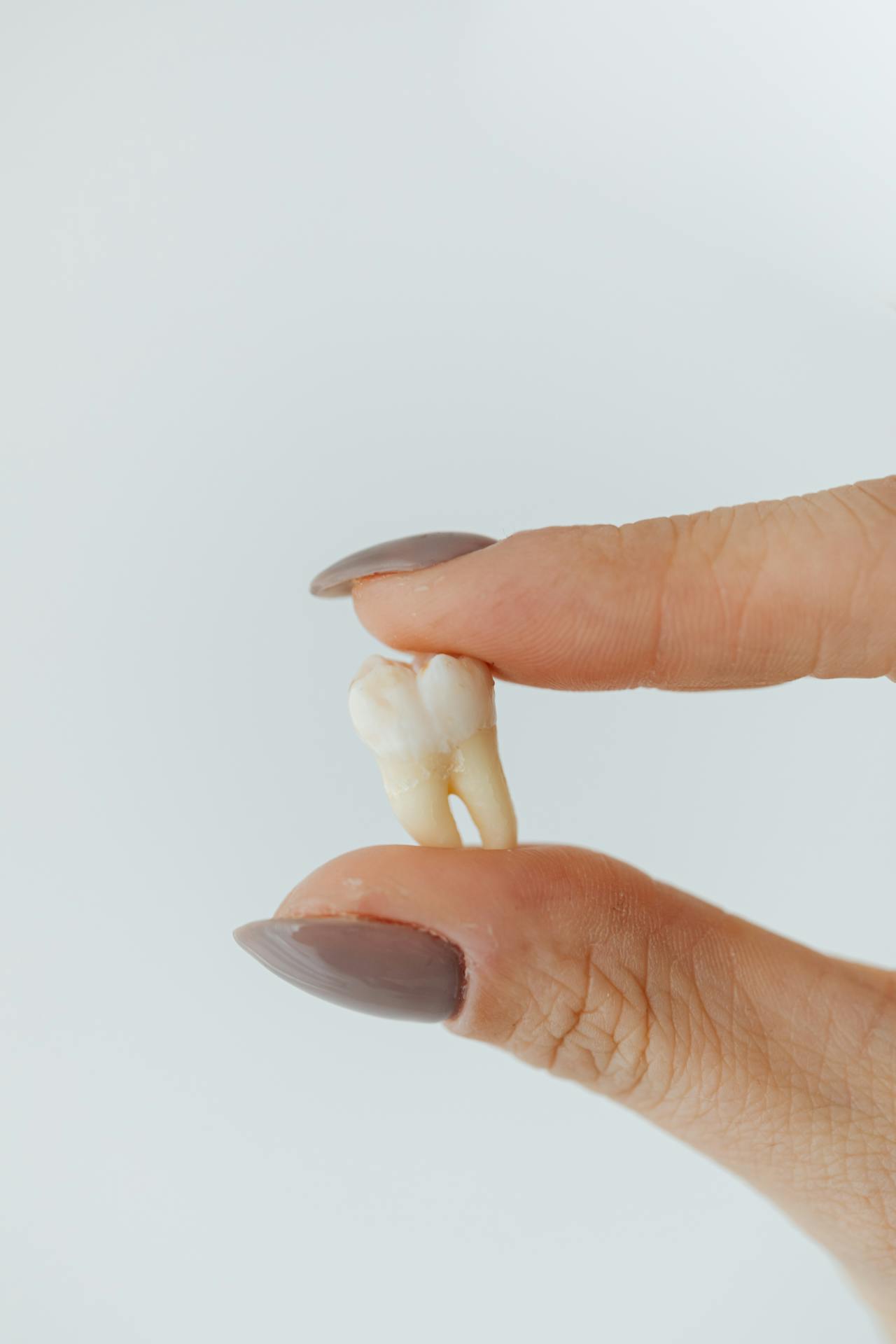 A dentist holding a model tooth to demonstrate the tooth extraction procedure at Victor Crescent Dental Clinic in Narre Warren, offering gentle and professional dental extractions.